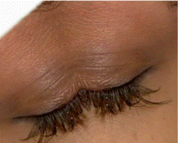 eyes